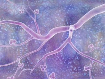 尖锐湿疣的危害有什么?承德男科医生告诉你